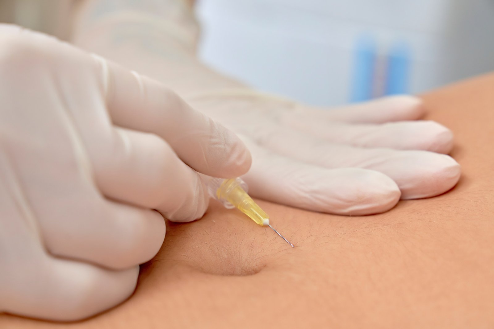 Linea Estética - Clínica de Estática em Campinas - Estética facial e corporal - cover